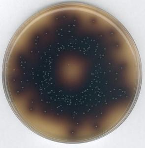 Gallenesculinazid-Agar