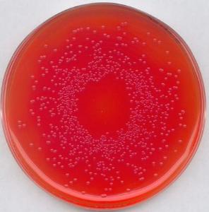 BPLS-Agar Brillantgrün-Phenolrot-Lactose-Saccharose-Agar