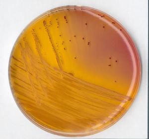 KF Streptococcus-Agar