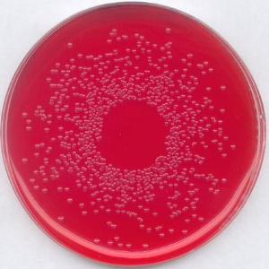 BPLS-Agar mod. Brillantgrün-Phenolrot-Laktose-Saccharose-Agar, mod.