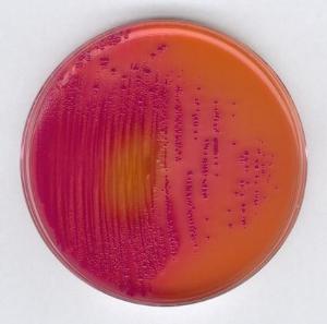 DHL-Agar gem. zu Sakazaki