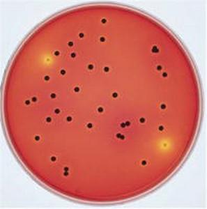 XLT4-Agar (Basis)