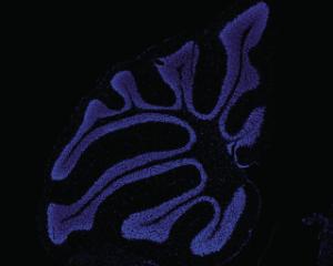 FL Mouse-cerebellum cell-imager