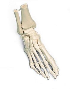 Loose foot and ankle skeleton, right