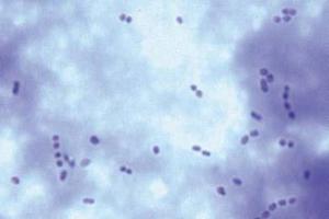 Milk souring organism (<i>Streptococcus lactis</i>) short chains