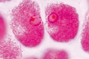 Nitrogen fixing bacteria in root nodules (<i>Rhizobium radicicola</i>)