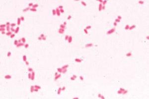 Colon bacteria (<i>Escherichia coli</i>) from culture