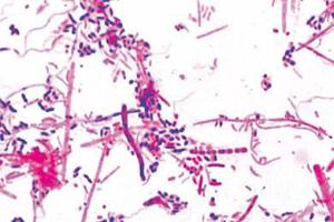 Bacteria from mouth, gram positive and negative rods, smear