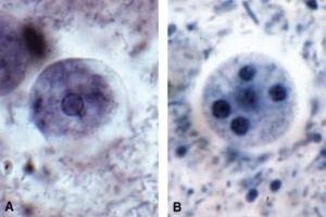 <i>Entamoeba histolytica </i>smear from feces