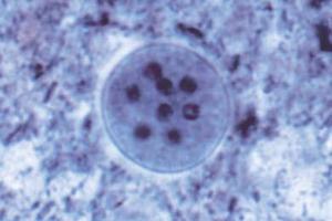 <i>Entamoeba coli</i> smear showing cysts