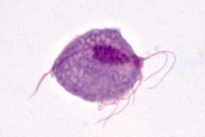 <i>Trichomonas vaginalis</i> smear