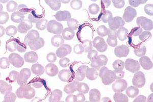 <i>Trypanosoma gambiense</i> blood smear