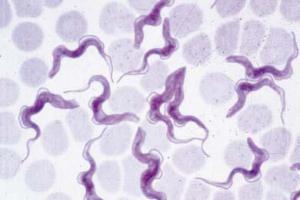 <i>Trypanosoma rhodesiense</i> blood smear