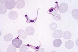 <i>Trypanosoma cruzi </i>blood smear showing trypanosomes