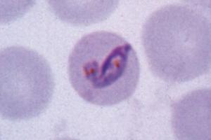 <i>Plasmodium malariae</i> blood smear