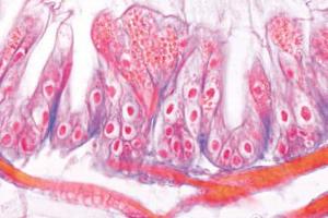 Honey bee (<i>Nosema apis</i>) dysentery, section of diseased intestine