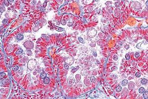 <i>Eimeria stiedae</i> causing coccidiosis in rabbit, liver section showing schizogony and all developing stages