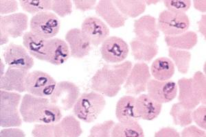 <i>Babesia canis</i> blood smear showing heavy infection