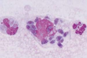 <i>Toxoplasma gondi</i> brain section showing cysts with parasites