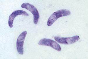 <i>Toxoplasma gondi</i> causing toxoplasmosis, tissue smear with parasites