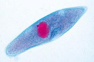 Paramecium macro- and micronuclei stained