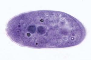 <i>Balantidium coli</i> human parasite smear with trophozoites